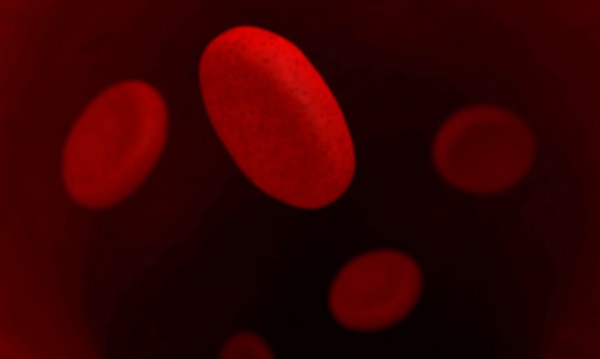 Anemia falciforme, pazienti africani sotto la lente